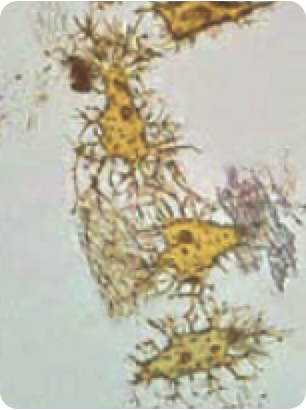 Dinosaur osteocyte cells, still soft and biological, not permineralized (i.e., not stone)